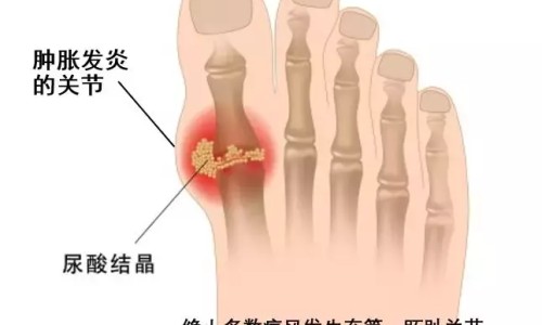 白血病能吃圆肉吗-白血病病人可以吃元胡止痛片吗网-分享白血病能喝元秘D吗，白血病病人可以吃元胡止痛片吗知识库
